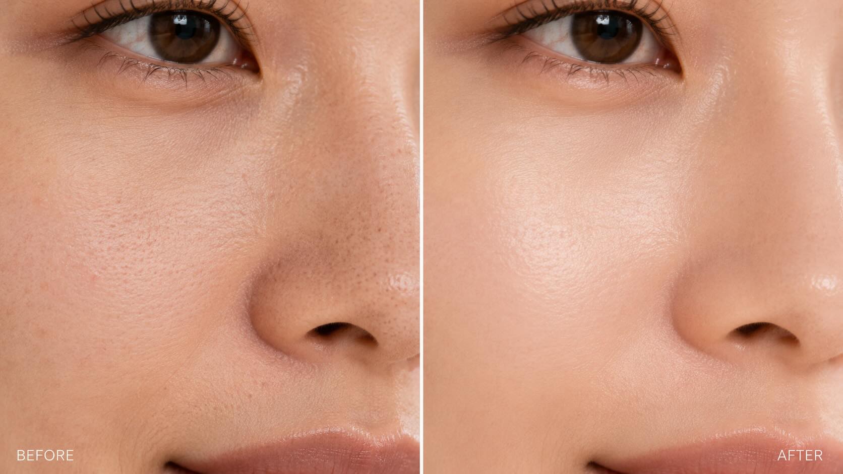 Before and after comparison of skin texture and congestion after 6 weeks of TOUCHBeauty Facial Cleansing Brush use