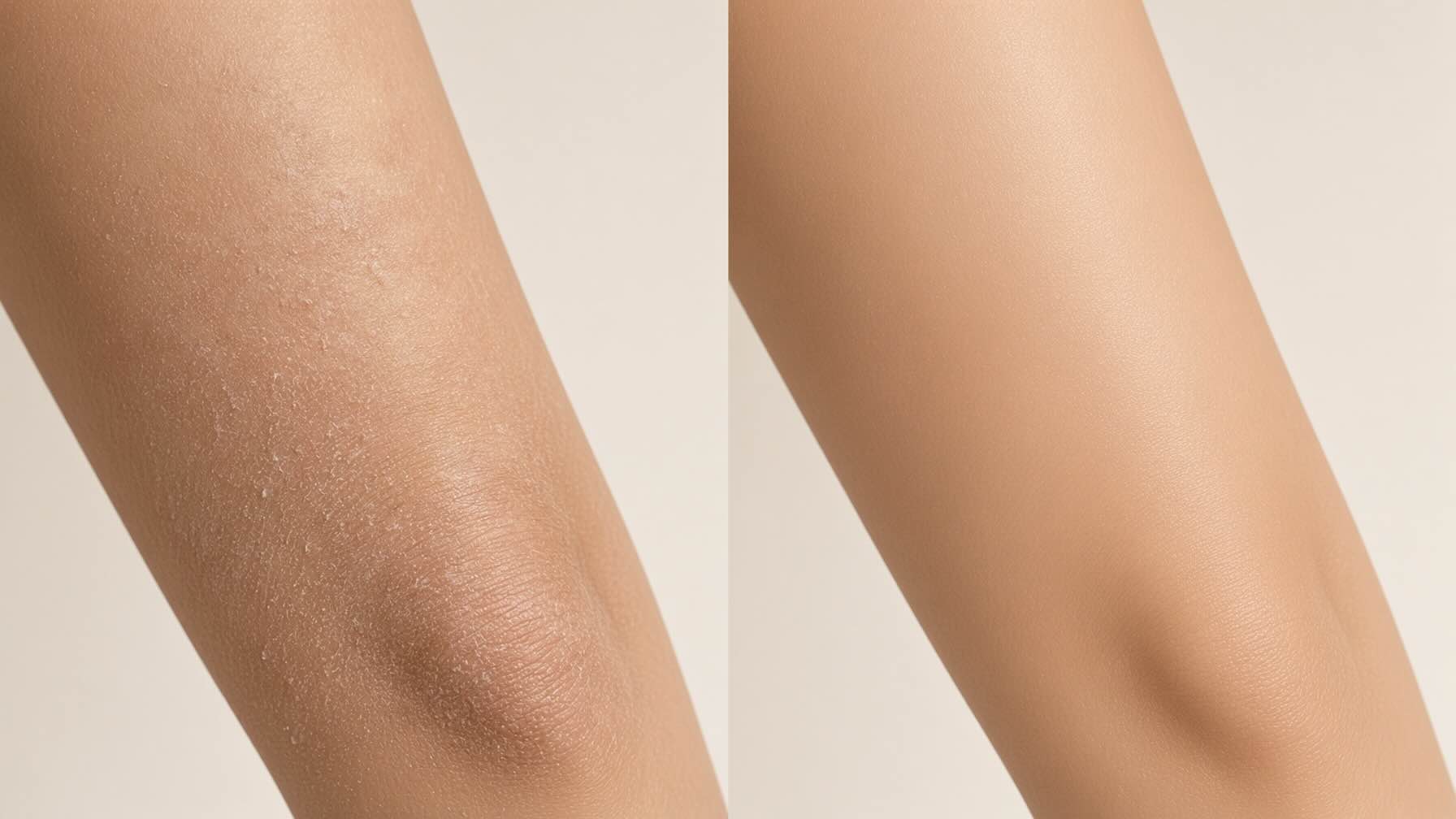 Before and after comparison of rough summer body skin on shins and elbows and consistently smooth soft skin after 6 weeks of Tree Hut Shea Sugar Body Scrub use